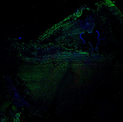 17PCW human midbrain